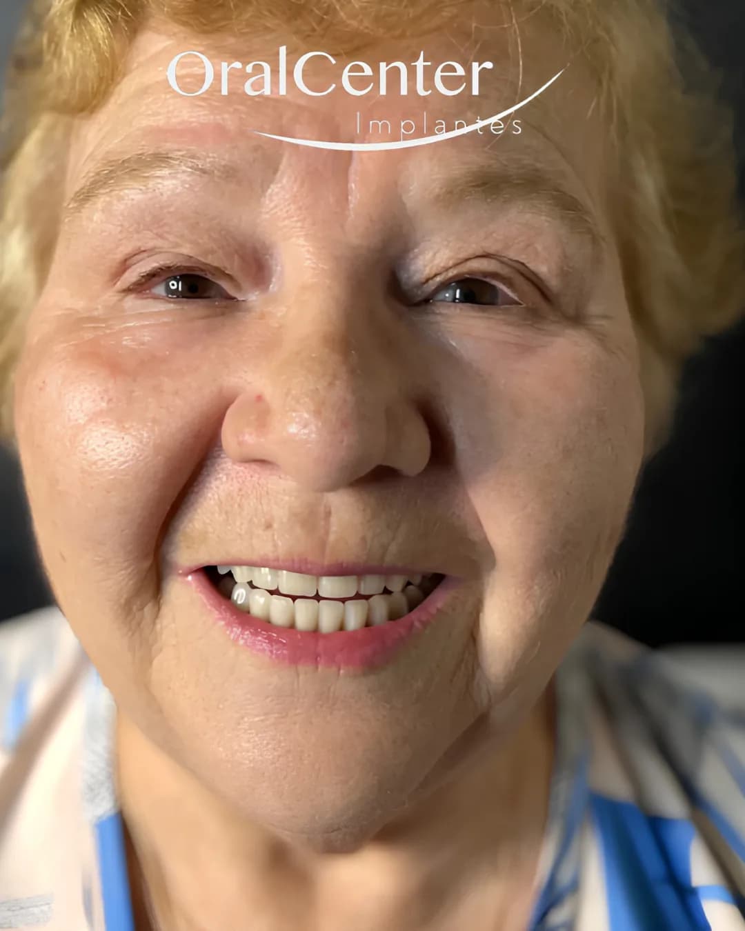 Paciente sorrindo após a reabilitação oral completa
