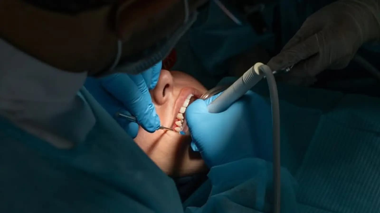 Procedimento cirúrgico odontológico em andamento